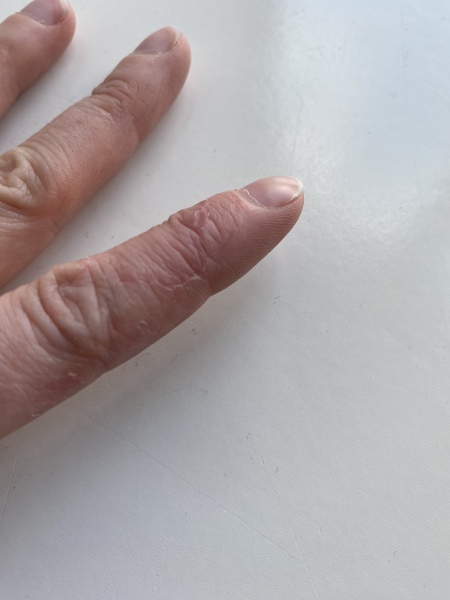 What is this on my finger? 