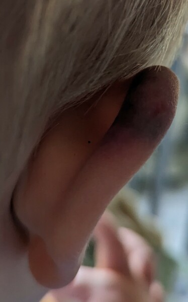 Does this need a GP? And would you be concerned? 