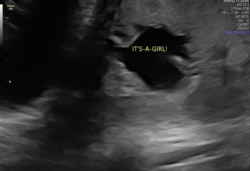Gender confirmation 