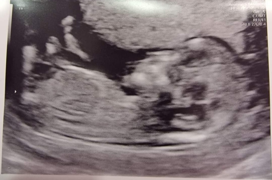 Just For Fun Guess Babys Gender 🤩🤩