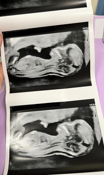 TWW - Testing Around 1st March 