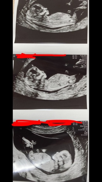 Gender guesses just for fun