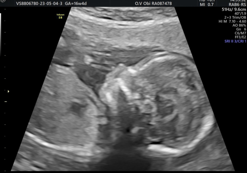 Due October 2023 - thread 6