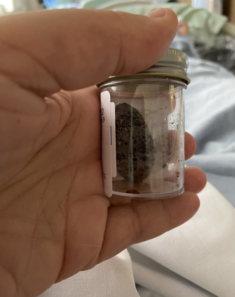 Gall Bladder removal - pls help me decide
