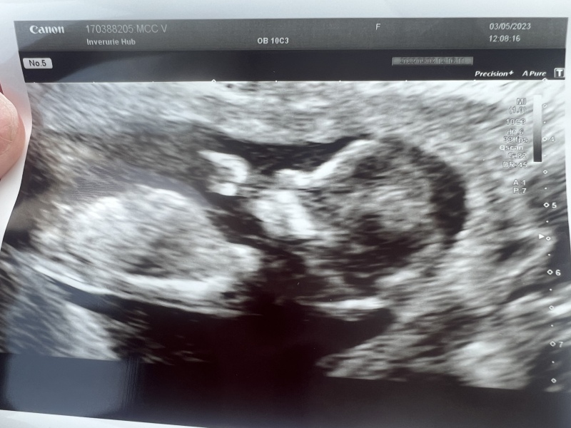 TWW - Testing Around 1st March 