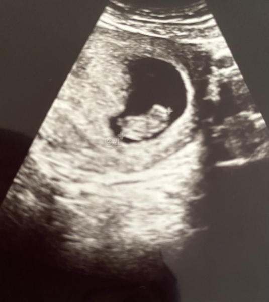 Due December 2023 part 2