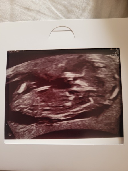 Due November 2023 Part 3