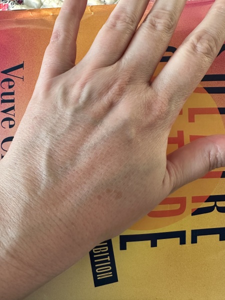 Just ageing hands or something to worry about?