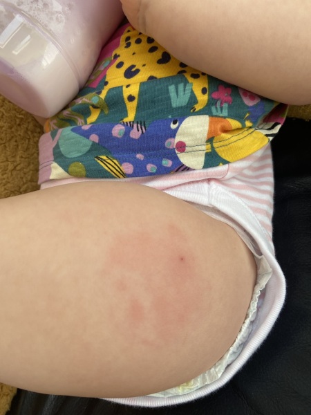 12 month jabs! Is this normal?