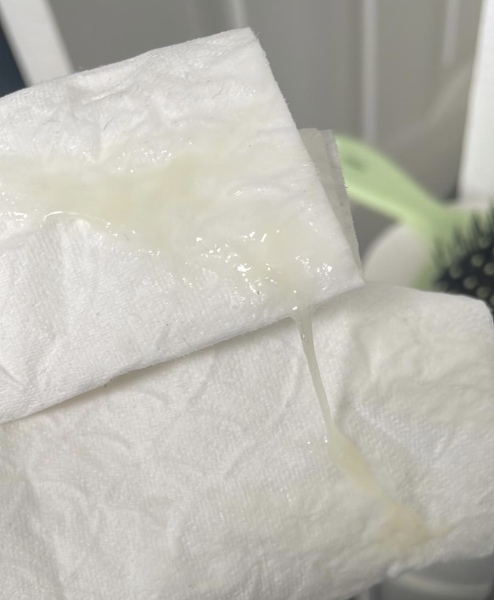 TTC / help..discharge (picture in comments)