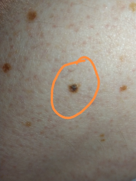 Should I get this checked? Does this look suspicious? 