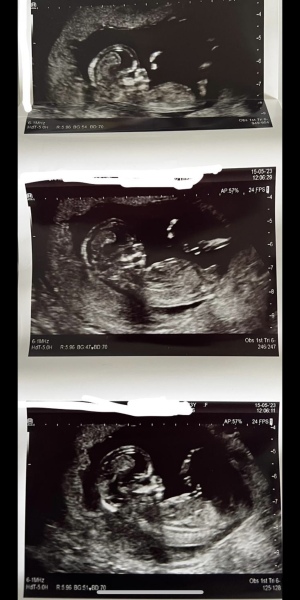 Due November 2023 Part 3