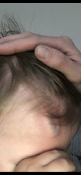 Does my toddler need A&E- urgent