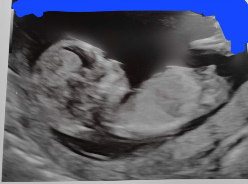 Boy or girl?