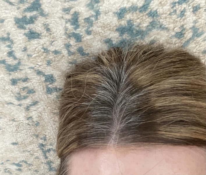 Grey hair really getting me down 