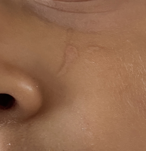 Son was scratched :(