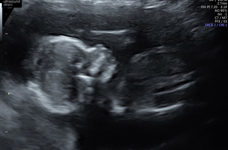 TWW - Testing Around 1st March 