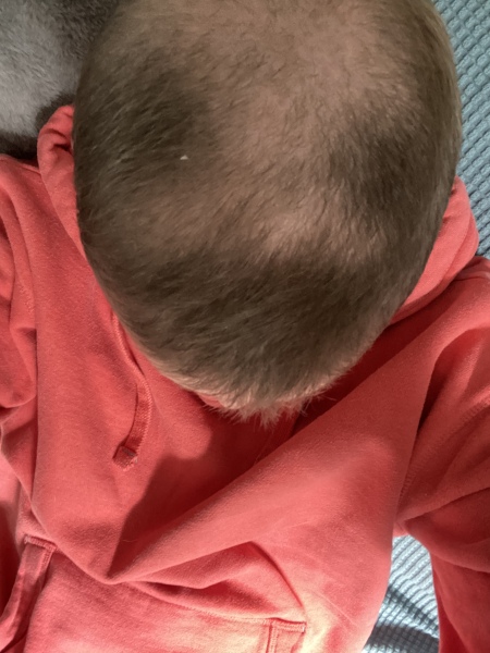 Cancer Support Thread 87 - everyone here is so supportive.