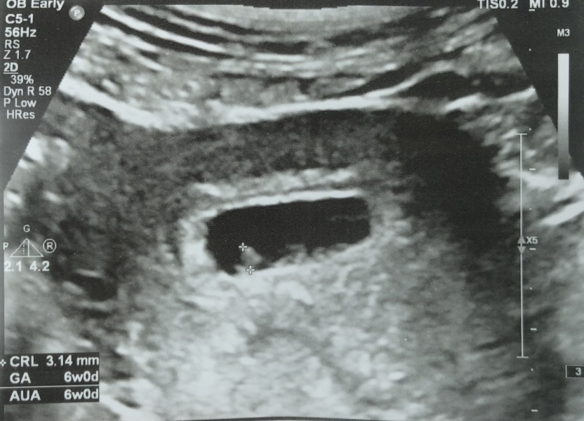Due January 2024 🎉 PART 2
