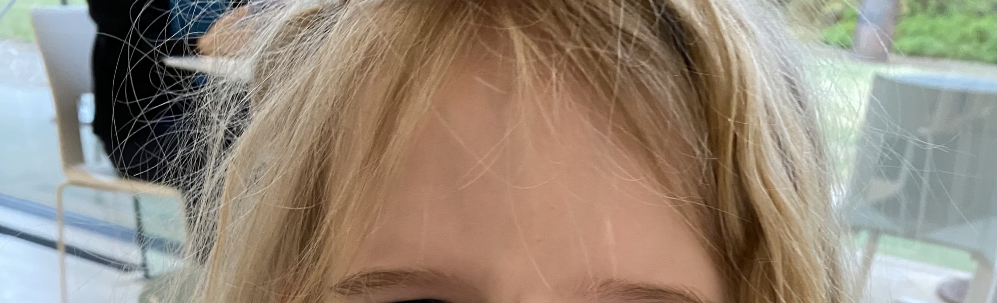 Help! Scar on my LO's face