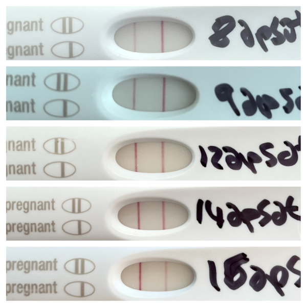 ERA/Alice/Emma infertility thread graduates/pregnancies