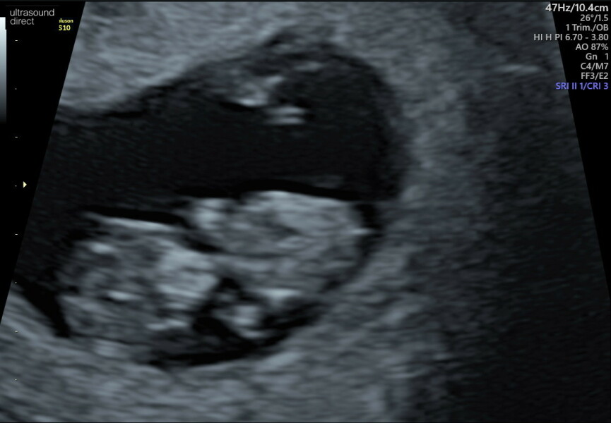 Due December 2023 part 3