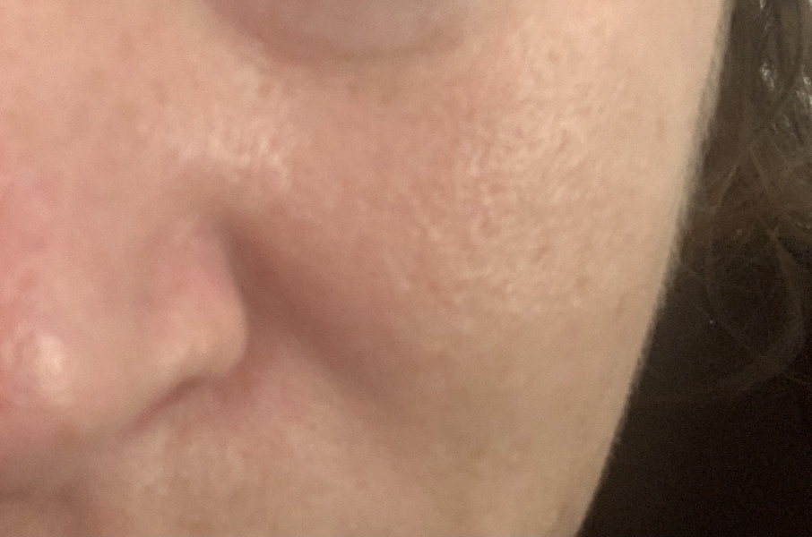 Photo of my skin - help 