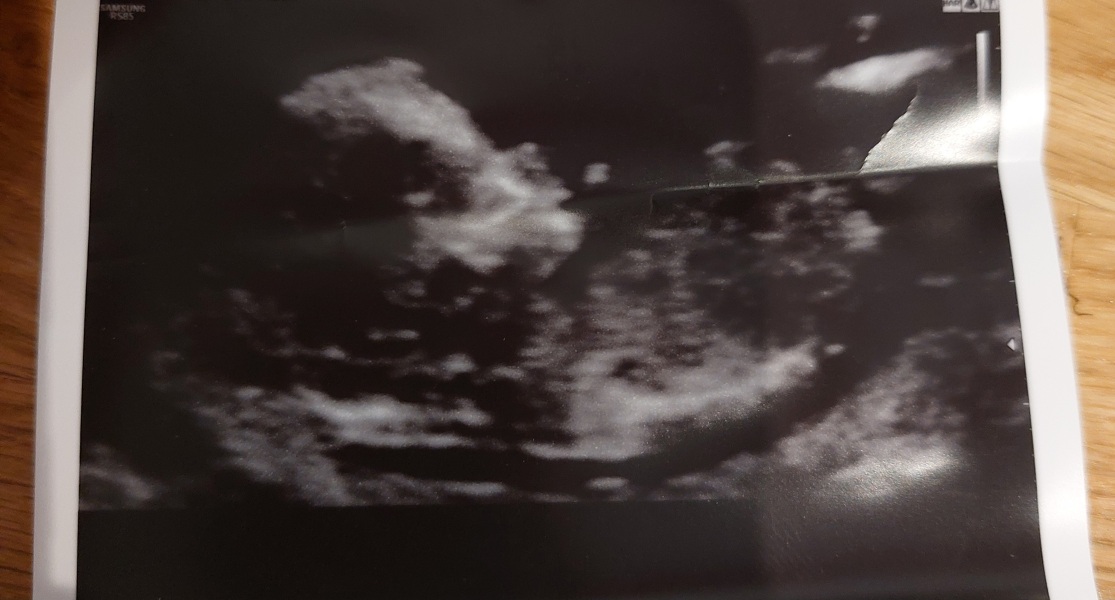 November 2023 babies - thread 4