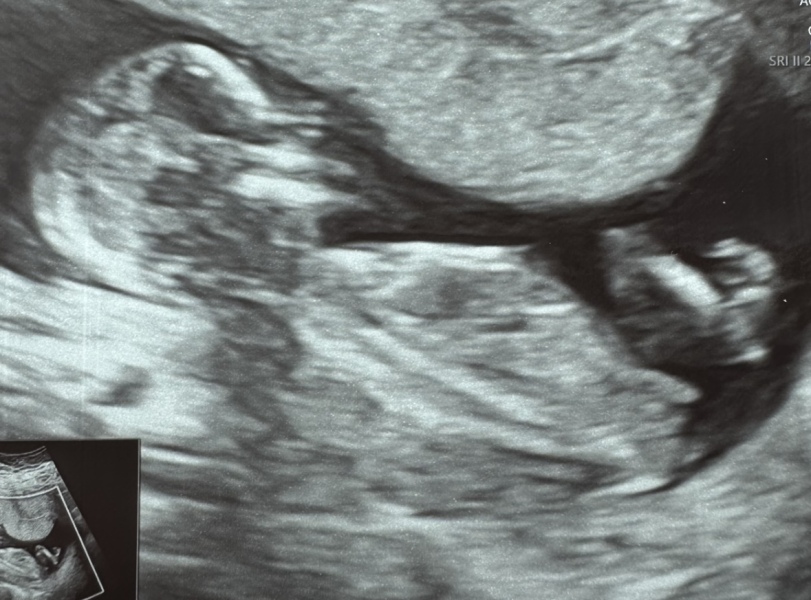 November 2023 babies - thread 4