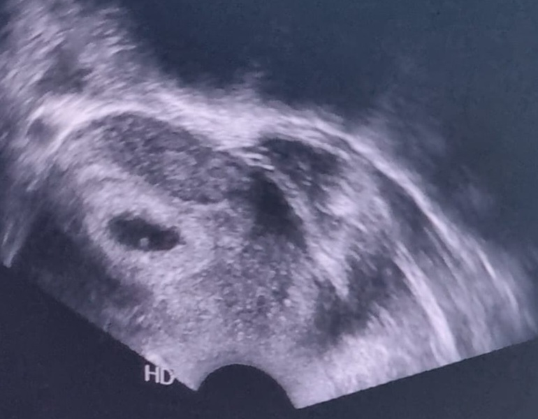 So upset - Are my clinic lying to me? 