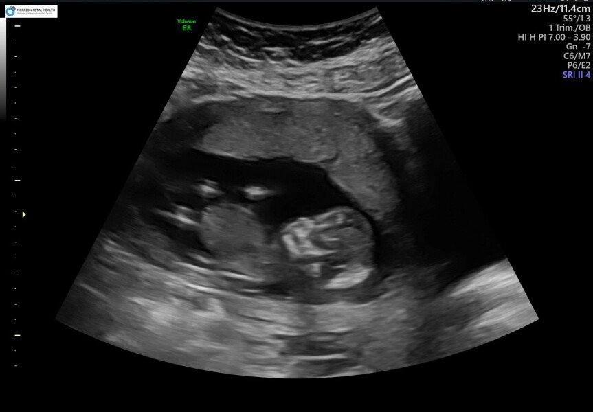 Due November 2023 Part 3