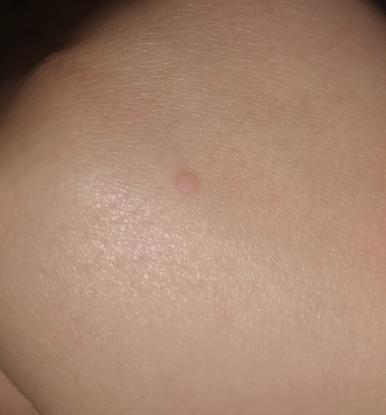 What is this on my hand? 