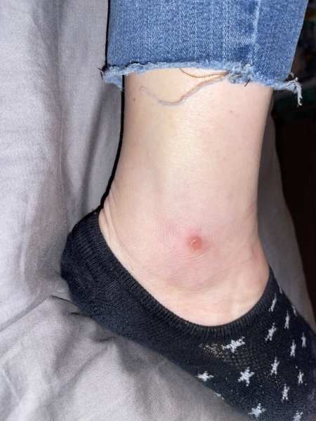What is this weird patch thing?