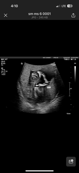 Due November 2023 Part 3