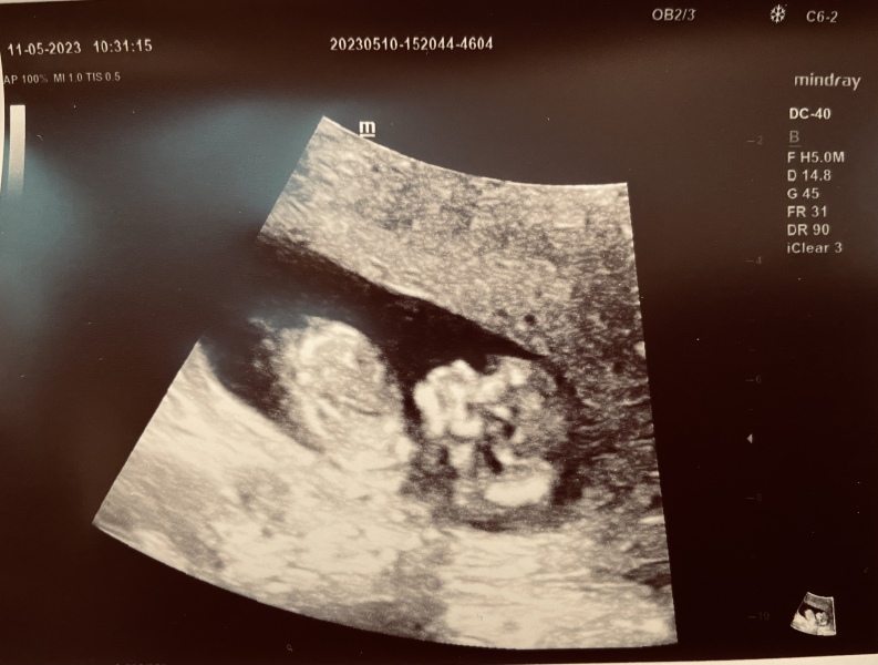 Due November 2023 Part 3