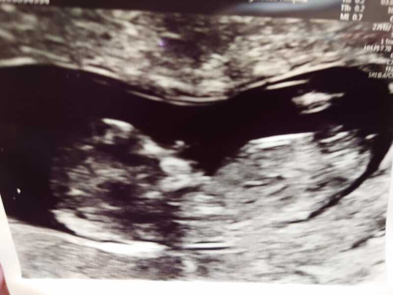 TWW - Testing Around 1st March 