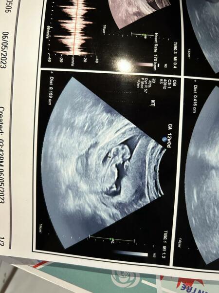 Girl or boy??