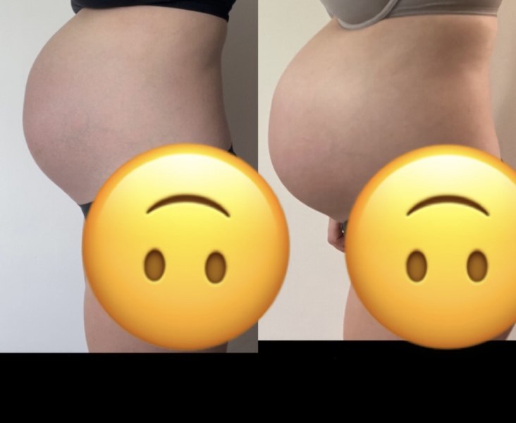 Has my bump dropped? 