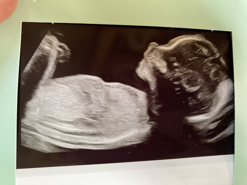 20 week scan - am I mad or am I seeing a uterus??
