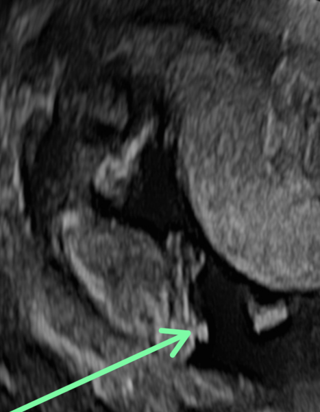 Is this a nub?! If so any guesses?