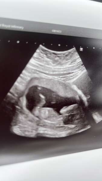 November 2023 babies - thread 4