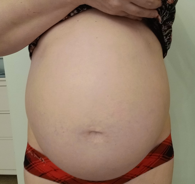 End Aug/Early Sept Due Date (Thread 2)