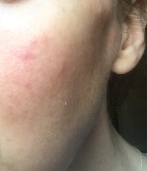 what are these spots? (pic)