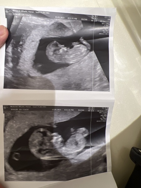 13 week gender guesses