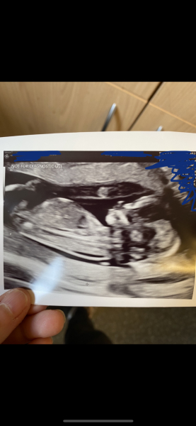 First scan gender