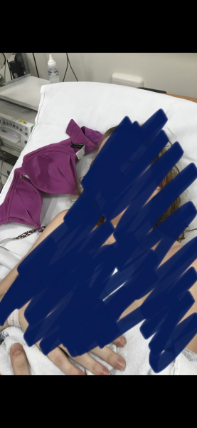 To still feel hurt I have no pictures from my daughters birth
