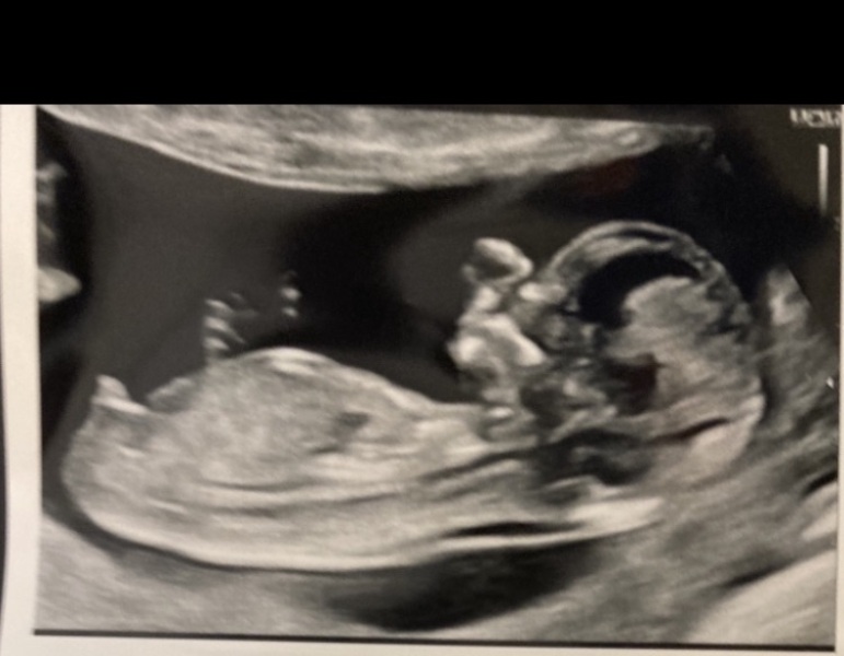 Definitely a boy??
