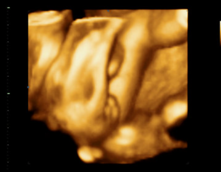 Due October 2023 - thread 6