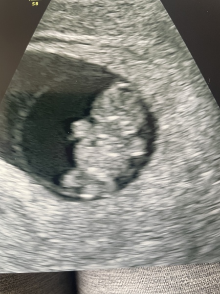 Due January 2024 🎉 PART 2