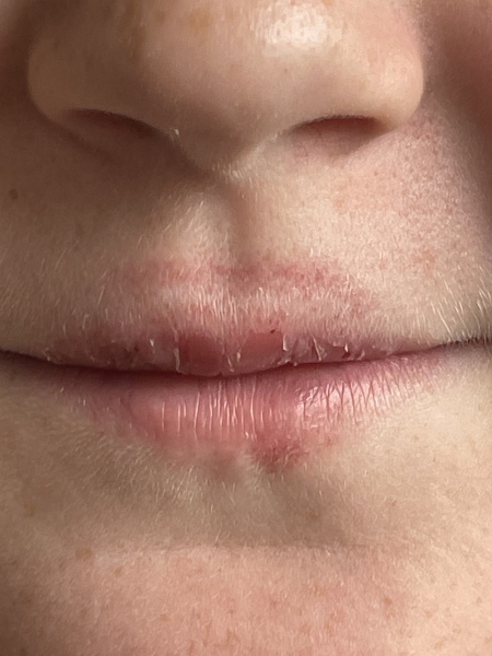 DD's lips